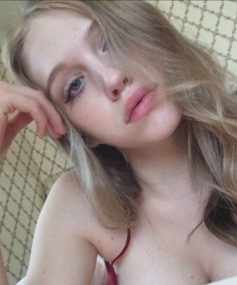 Альбина